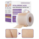 Surgical Soft Silicone Gel Scar Sheet Patch Treatmen Removal Tape Acne Trauma Burn Scar Cover Skin Repair Section Ear Beauty