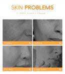 Sabonete Facial com Vitamina C 50g Hidratante, Limpeza Profunda, Refina os Poros, Ilumina a Pele - Produto Coreano para Cuidados com a Pele