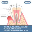 Sérum reparador de gengivas, melhora a sensibilidade dentária, reduz o inchaço gengival, elimina o mau hálito, produtos para cuidados dentais, gotas para alívio das gengivas 30ml
